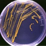 Agar_plate_with_colonies