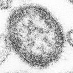Sobre el origen del sarampión y su erradicación