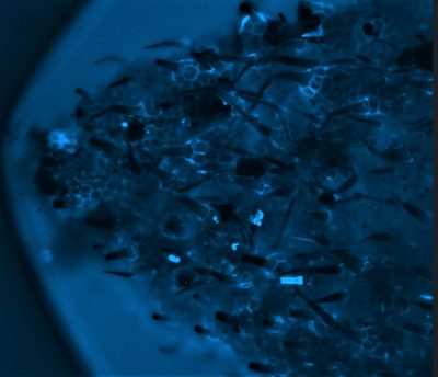 12-Iron-plant, despliegue de armaduras