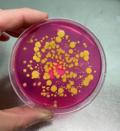 12-Microbios desde diferentes perspectivas