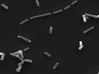 13-EcPaSEM_Bessa LJ_Photo 2