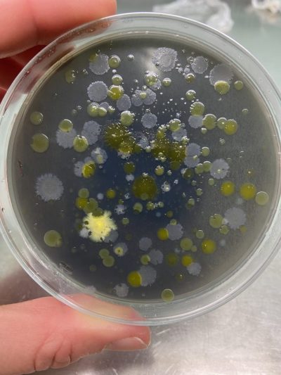 13-Microcosmos en placa la explosion de las bacterias