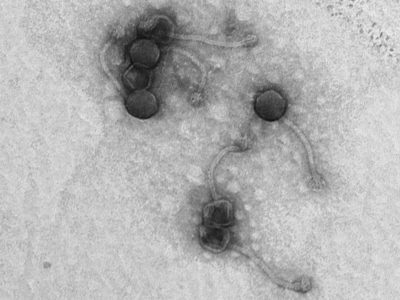 SCSIE MICROSCOPIA U.V.
08/06/2023
11:55:05
50000
7.0
100.0
Imaging




 -340
 -141

XpixCal=4.608624
YpixCal=4.608624
Unit=nm
##fv3