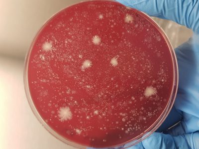 15-Microbiota intestinal estamos llenos de diversidad