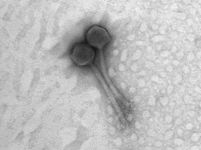 SCSIE MICROSCOPIA U.V.30/05/202310:49:10500007.0100.0Imaging -398 -447XpixCal=4.608624YpixCal=4.608624Unit=nm##fv3