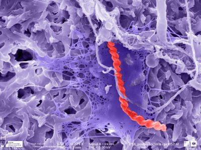 18-Qué hace una espiroqueta en arena del Sahara