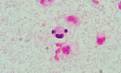 2-Una sonrisa contagiosa