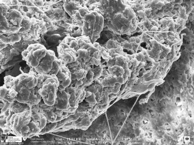 20-Polvo atmosférico. qué microorganismo fabrica telarañas
