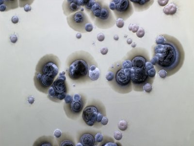 21-Actinomicetos en erupción