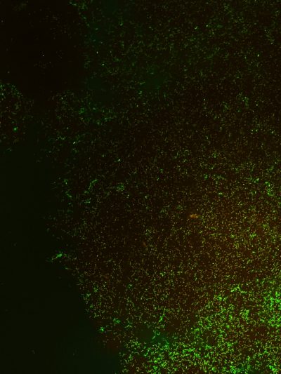 29-Fireworks in a biofilm