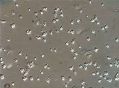 4- Hemocitos de Crasostea gigas