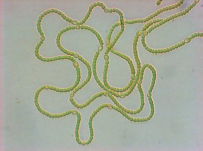 Anabaena (Nostoc) sp. PCC7120 (Nitrógeno atmosférico)