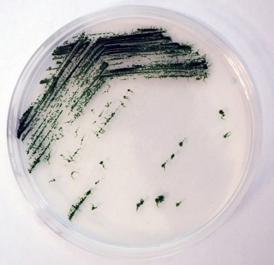 Anabaena (Nostoc) sp. PCC7120