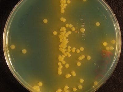 E. coli en medio CLED