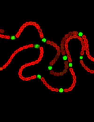 Expresión diferencial GFP en heterocistos