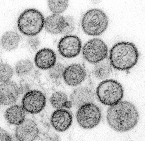 Date:??
CDC/ Cynthia Goldsmith, Luanne Elliott

Transmission electron micrograph of Sin Nombre virus.

Transmission electron micrograph of Sin Nombre virus.  Hantavirus.