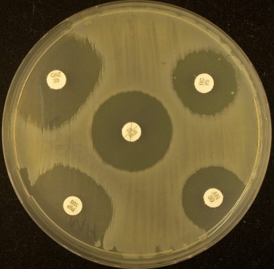 Inducción de cefalosporinasa cromosómica