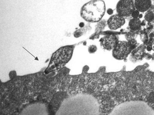 Mycoplasmapneumoniae