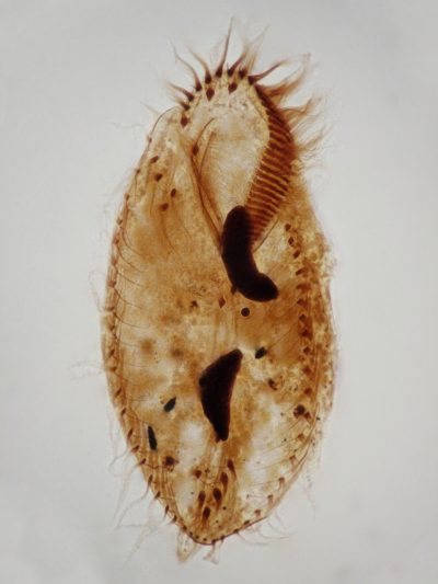 Oxytricha sp