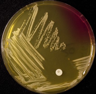 Staphylococcus Saprophyticus