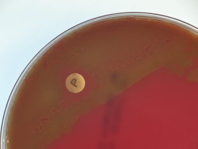 Streptococcus pneumoniae