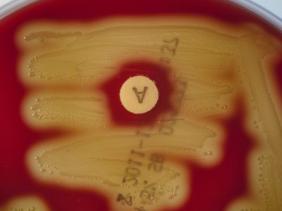 Streptococcus pyogenes 2